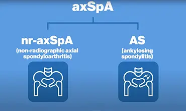 axspa video thumbnail