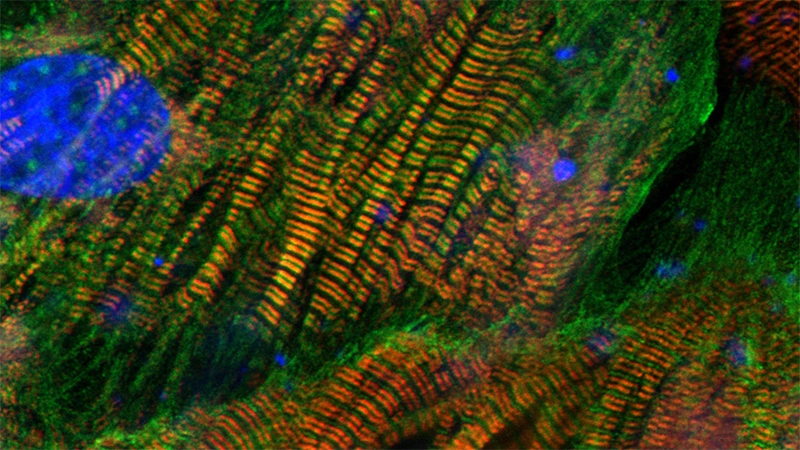 Heart muscle cells.